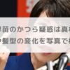 高市早苗のかつら疑惑は真相は？眉毛や髪型の変化を写真で検証！